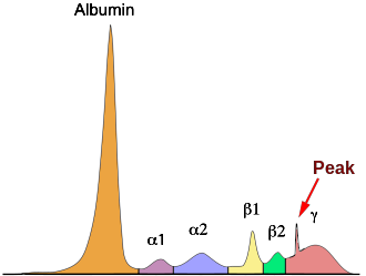 Bild "Nase:Elektrophorese3.png"